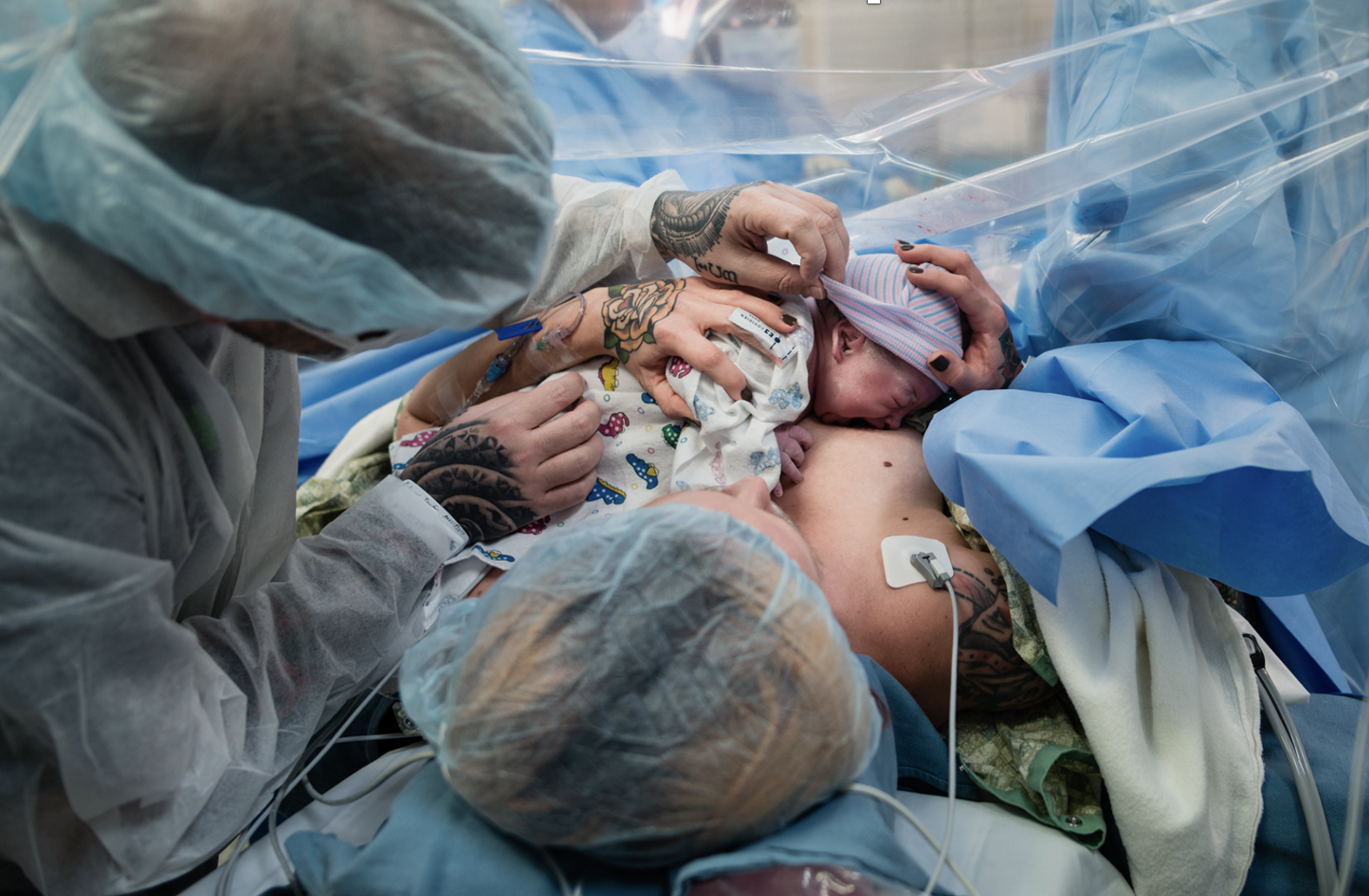 Doula Support for Scheduled C-Sections